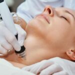 radiofrekwencja mikroigłowa