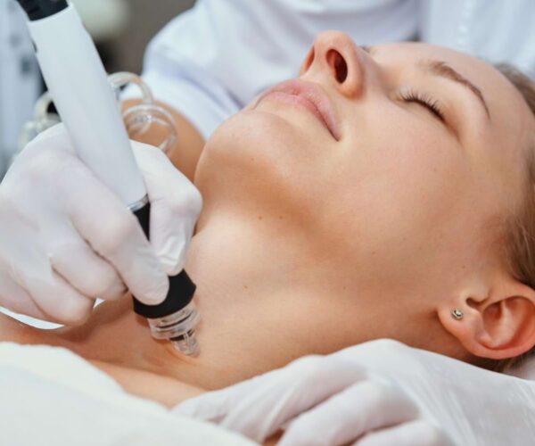 radiofrekwencja mikroigłowa