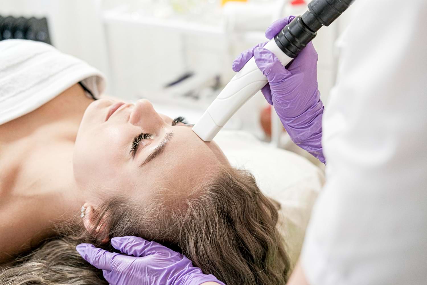 radiofrekwencja mikroigłowa